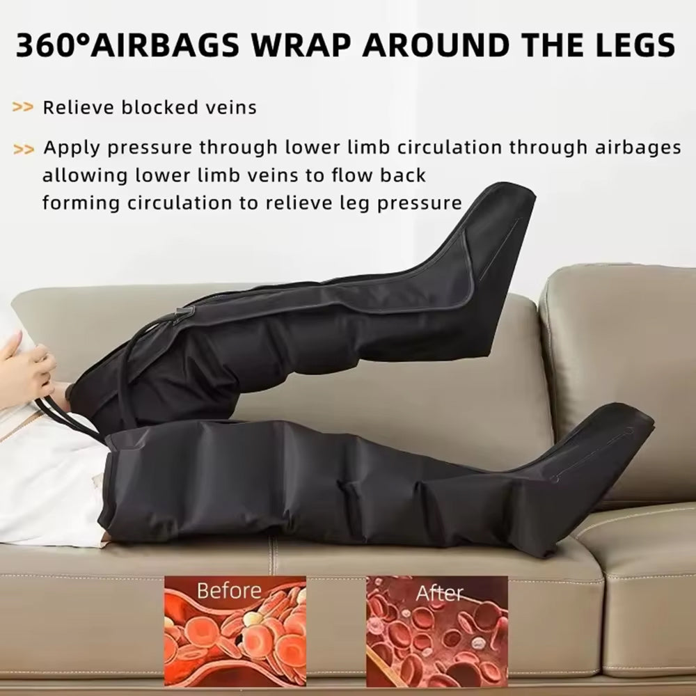 RefosLeg
