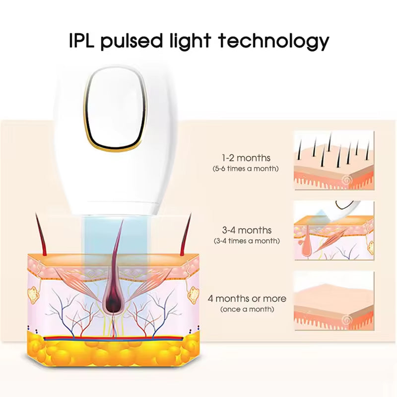 MovixLin Laser Hair Removal Handset | At-Home IPL Device